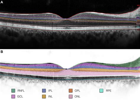 retinal layer thickness tool